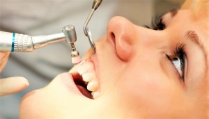 Ультразвуковая чистка зубов в клинике