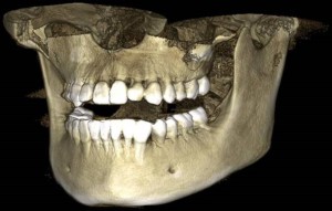 3D-снимок зубов 